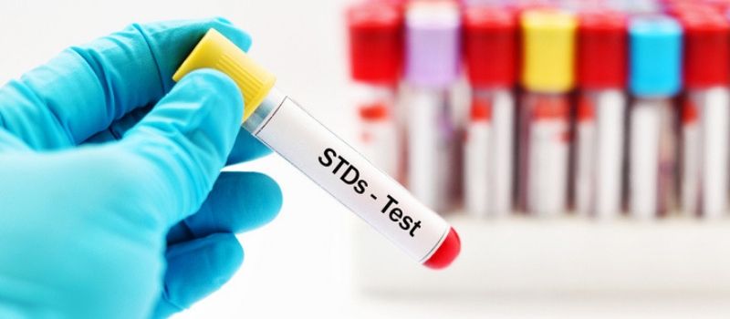 When do Symptoms of an STD Start